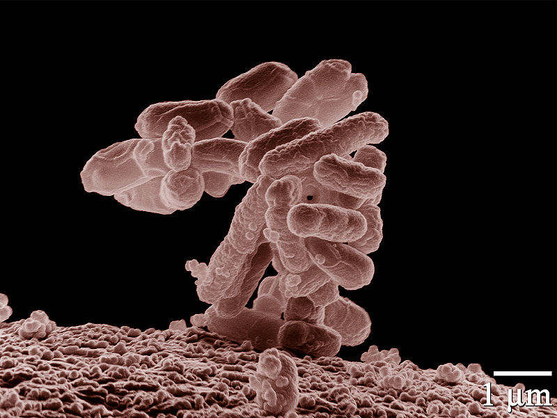 e-coli